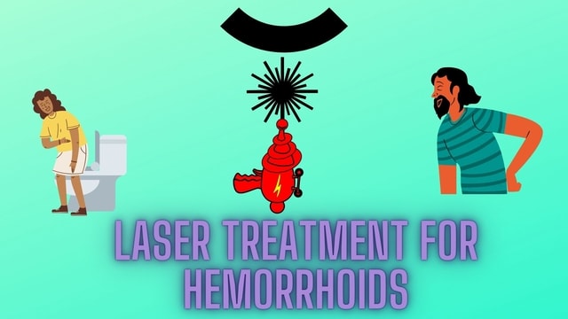 laser treatment for hemorrhoids